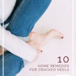 10 Home Remedies for Cracked Heels #naturalremedies #homemade - DontMesswithMama.com
