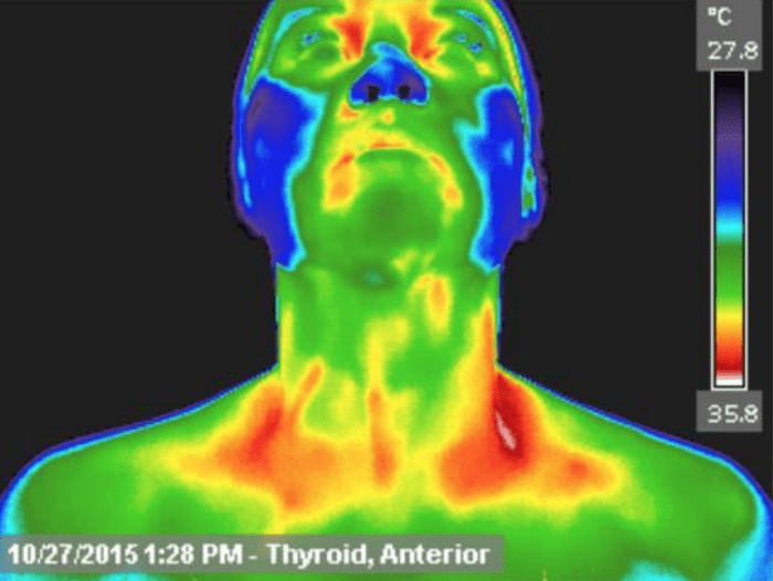 heat map of human head