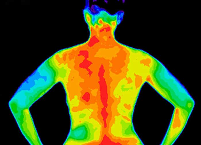 Thermography screening