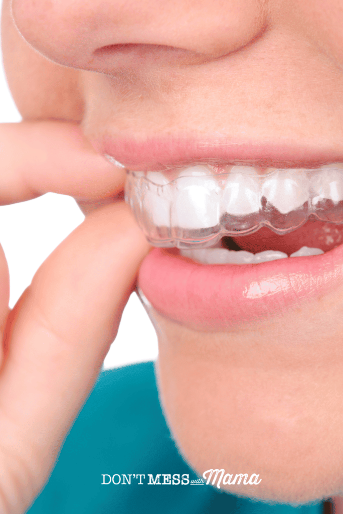 woman putting clear plastic retainers into mouth
