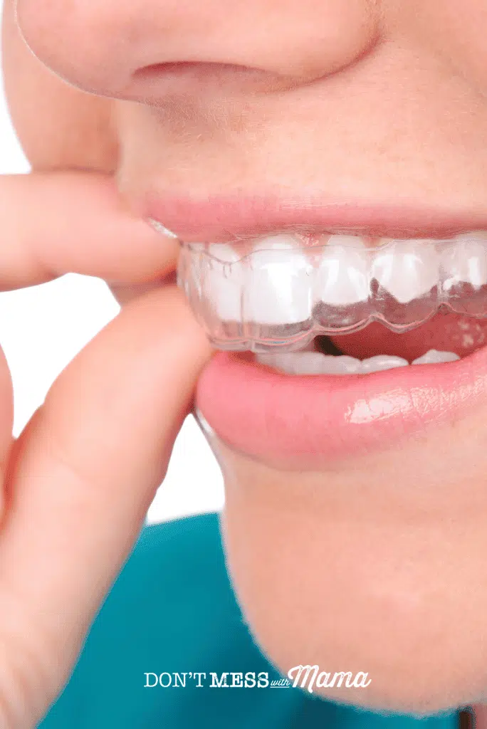 woman putting clear plastic retainers into mouth