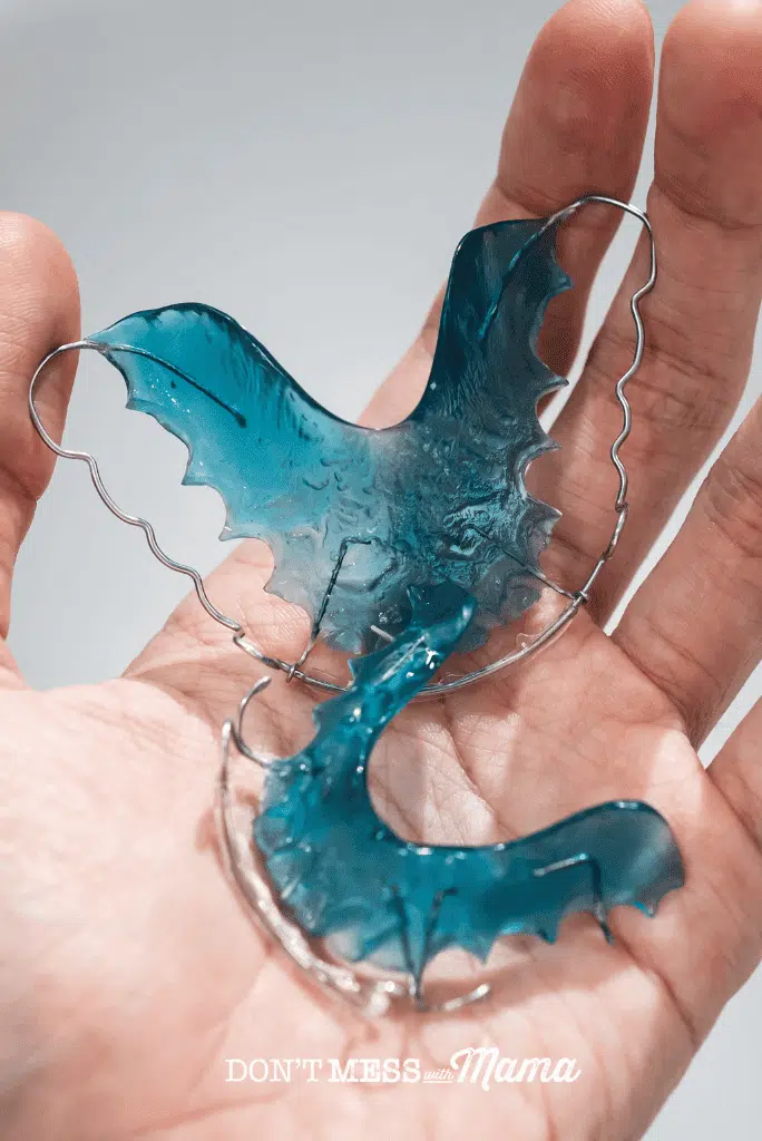 blue metal retainers in palm of hand